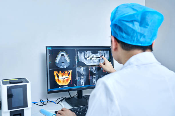 Best Emergency Dental Extractions in East Palo Alto, CA