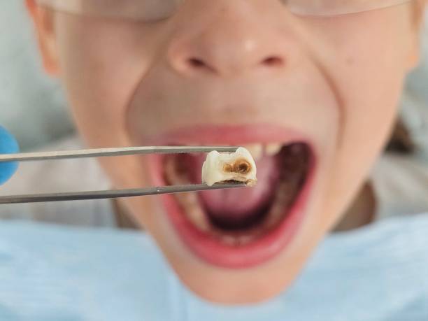 Best Pediatric Emergency Dentist in East Palo Alto, CA